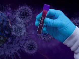 RT PCR test in Nairobi