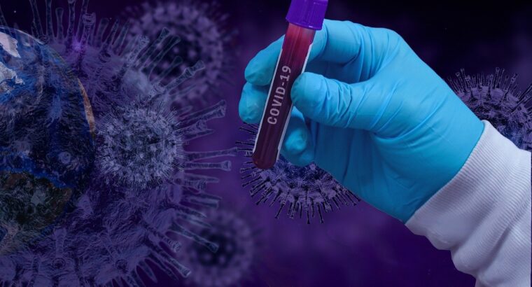 RT PCR test in Nairobi