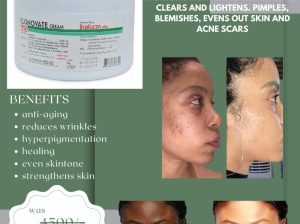 Clonovate cream 450gms